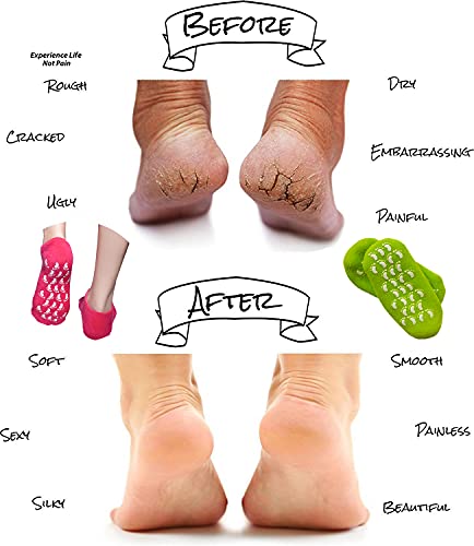 Moisturizing Socks, Gel Socks Soft Moisturizing Gel Socks, Gel Spa Socks For Repairing And Softening Dry Cracked Feet Skins (Women Size(Rose Red & Green)) #TOP3