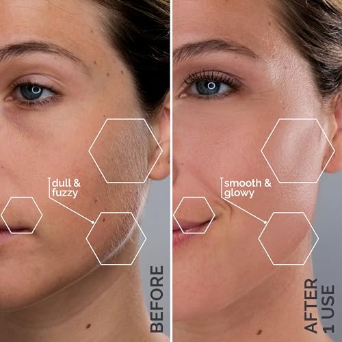 Michael Todd Beauty - Sonicsmooth – SONIC Technology Dermaplaning Tool - 2 in 1 Women’s Facial Exfoliation & Peach Fuzz Hair Removal System with 8 Weeks of Safety Edges
