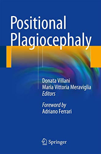 Positional Plagiocephaly view 2