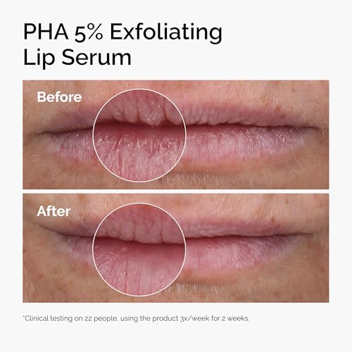 The Ordinary PHA 5% Exfoliating Lip Serum, Hydrating Overnight Lip Exfoliator Treatment, 15ml