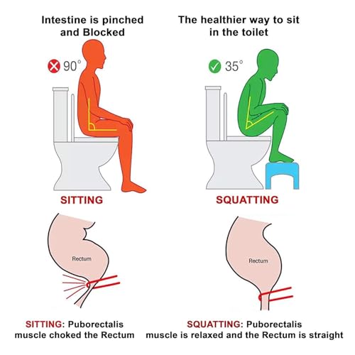 MOMENT Toilet Squat Stool Non Slip Plastic Toilet Step Stool Potty Stool, Bathroom Foot Rest Squatting Posture Poop Stools for Adults and Kids Improve Bathroom Posture and Comfort, 39x23x17cm (White)