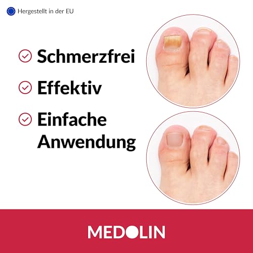Medolin® Nagelpilz Lösung - Wissenschaftlich bestätigte Wirkung - Effektiver Nagellack für schöne & gepflegte Nägel | Nagelhärter | Geeignet für Fuß & Hand, 10 ml