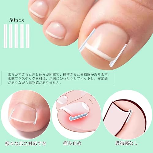 Chisafly 巻き爪クリップセット