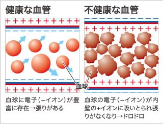Amazon.co.jp: YBIの魔法のネックレス パワーネック／スーパー