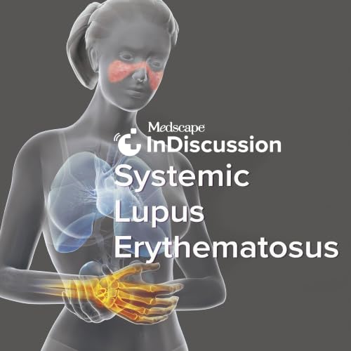 『Medscape InDiscussion: Systemic Lupus Erythematosus』のカバーアート