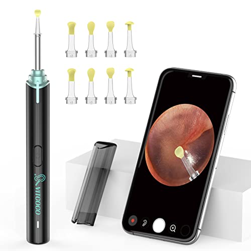 👂【Sicurezza e comfort Otoscopio】 il materiale in silicone liscio non è né duro né morbido e ha un angolo di inclinazione adatto, che non solo pulisce efficacemente l'otoscopio, ma non graffia il condotto uditivo. L'anello di protezione può proteggere le orecchie del tuo bambino.Con un design intelligente a temperatura costante, la temperatura di Otoscopio è simile a quella del plasma umano, rendendolo più sicuro e più comodo da usare!