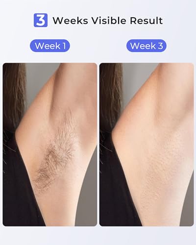 LUBEX Painless Sapphire Ice Cooling IPL Laser Hair Removal Device at Home for Women & Men, 1,000,000+ Unlimited Flashes, Safe and Permanent, Alternative to Salon Hair Removal for Face, Body, Bikini - Image 4