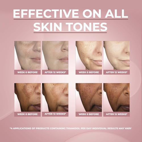 Image of Eucerin Anti-Pigment Dual Serum 30ml, Anti-Pigment Serum for Treatment of Age Spots and Uneven Skin Tone, Advanced Skincare with Hyaluronic Acid (Pack of 2)