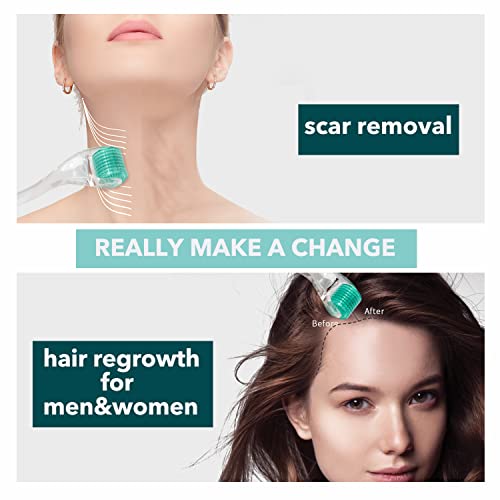 AUDUODUO® Derma roller 192 echte nadeln 0.5mm mit REAL SILVER Nadeln Microneedle roller for Face