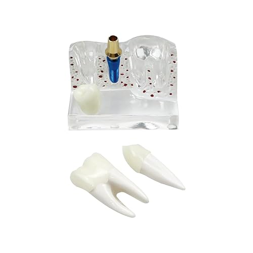 Miniatura 55 de 2 modelos de dientes estándar, modelo dental para adultos, modelo estándar de demostración de Typodont para niños, enseñanza dental, pantalla