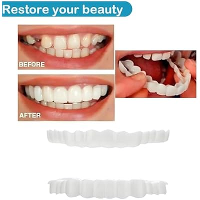 Teeth Whitening - Teeth Restoration Kit, an Effective Solution to Cover Tooth Stains and Restore Teeth, Restoring Your Smile