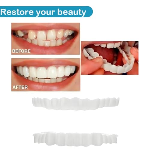 Image of Teeth Whitening - Teeth Restoration Kit, an Effective Solution to Cover Tooth Stains and Restore Teeth, Restoring Your Smile
