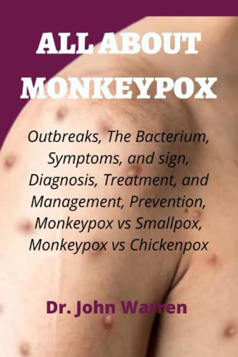 ALL ABOUT MONKEYPOX: Outbreaks, The Bacterium, Symptoms, and sign, Diagnosis,