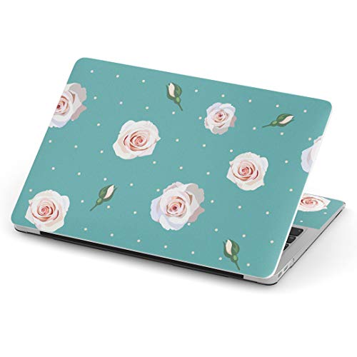 igsticker Macbook Pro 13inch 2020/19/18/17/16 ��p�X�L���V�[�� A1989 / A1706 / A1708 �}�b�N�u�b�N �v�� 13�C���` ��p�V�[�� �t�B���� �X�e�b�J�[ �A�N�Z�T���[ �ی� 011099 ��