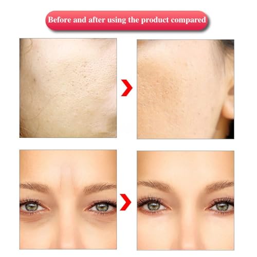 Image of Derma Pen with 2 Extra 12 Needles Cartridges Derma Pen | Mesopen for Anti Aging | Skin Facial Care | Skin Rejuvenation (N2-C WIRE)