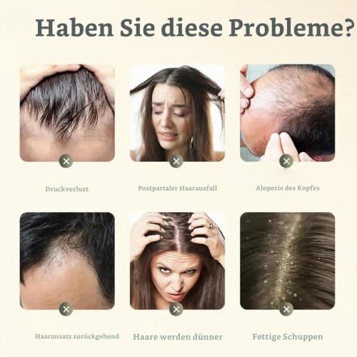 Ginger Anti Hair Loss Shampoo,Haarwachstum Shampoo,Polygonum Multiflorum Ginger Plant Extract Hair Care,Pflanzenextrakt ShampooGegen Haarausfall, Natürlich Bio Anti-Haarausfall