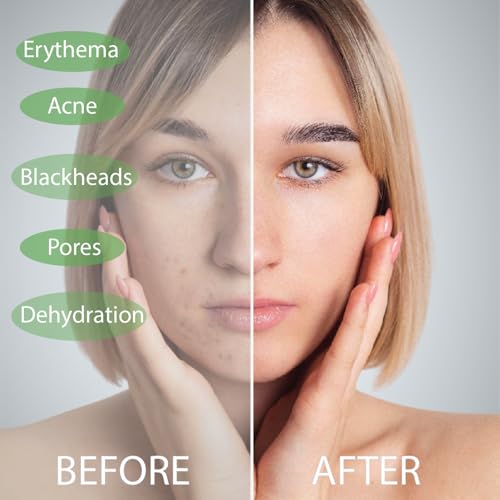 Disposable-Face-Towels-Ultrasoft-Super-Strong-Biodegradable-Reusable-Cleansing-Wipes-Makeup-Remover-Wipes-Disposable-Clean-Towel-10x12-in