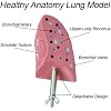 4-Piece Set YANHAO Smokers Lung Model + Healthy Lung Model, Life-Size Human Lung Anatomy Models with Pathological Features for Demonstrating Smoking Effects