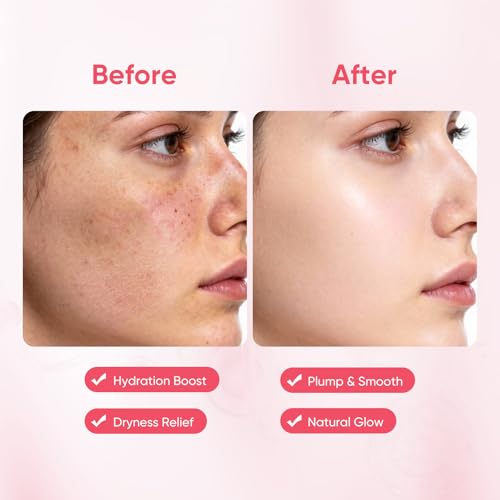 AOPEIBOTO Collagen Face Masks, Hydrating Moisturizing Sheet Mask with Soluble Collagen & Hyaluronic Acid, Face Mask Pack Improves Skin Dryness & Tightness, Pack of 10 — view 5