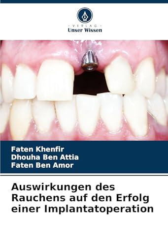 Auswirkungen des Rauchens auf den Erfolg einer Implantatoperation für 43,90 EUR bei amazon.de Bild: Auswirkungen des Rauchens auf den Erfolg einer Implantatoperation für 43,90 EUR bei amazon.de
