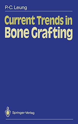 Current Trends in Bone Grafting view 2