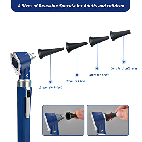 Scian Otoskop Kit – Ear Scope Otoskop mit LED Licht, 3 fache Vergrößerung, 4 Speculum Tips Größe, leichtes Diagnostik Ohrpflege-Tool für Kinder, Erwachsene, hunde, Heimgebrauch (Blau)
