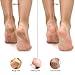 RED by Kiss Stainless Steel Ped Egg Foot File 2 in-1 Callus Remover for Dry and Wet Feet, Smooth Rough Skin, Include 2 Grit (Soft & Hard), Washable Foot Scrubber for Cracked Heels