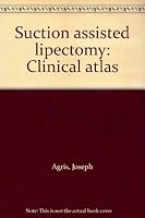 Suction assisted lipectomy: Clinical atlas B0006ECTQ8 Book Cover