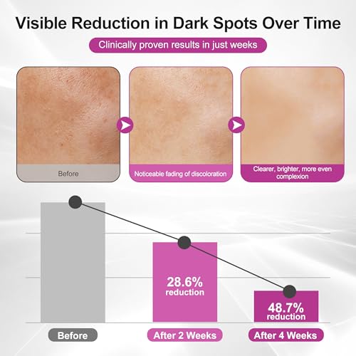 Dark Spot Remover for Face and Body, Age Spot Sun Spot Freckles Remedy Corrector Serum, 360° Roller Applicator, with Vitamin C and Glutathione, 0.7 Fl Oz