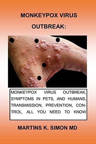 MONKEYPOX VIRUS OUTBREAK:: MONKEYPOX VIRUS OUTBREAK, SYMPTOMS IN PETS, AND HUMANS, TRANSMISSION, PREVENTION, CONTROL, ALL YOU NEED TO KNOW ABOUT MONKEYPOX