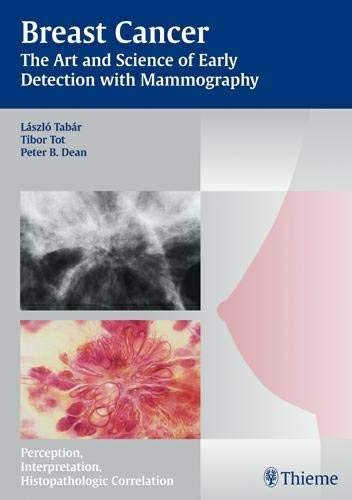 Breast Cancer - The Art and Science of Early Detection with Mammography: The Art and Science of Early Detection with Mammography - Perception, Interpretation, Histopathologic Correlation