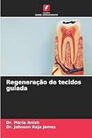 Regeneração de tecidos guiada (Portuguese Edition) 6202456973 Book Cover