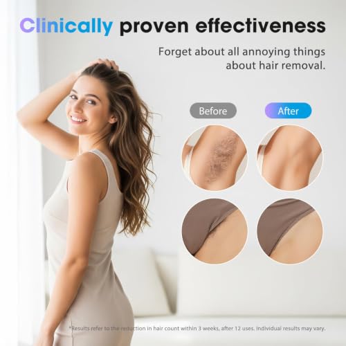 Image of Laser Hair Removal Device for Women & Men, At-Home IPL Device 45F Ice-Cooling for Painless & Long-Lasting Results, Visible Results in 3 Weeks,Full Body & Bikini Line, Off White