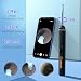 LMECHN 1920P HD Ear Wax Removal Tool with Camera, Slim Wireless Ear Otoscope, 6 Lights, IP67 Waterproof Ear Cleaner with 8 Skin-Friendly Silicone Scoops for iPhone, iPad & Android. gallery 3