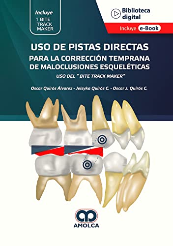 USO DE PISTAS DIRECTAS PARA LA CORRECCION TEMPRANA DE MALOC