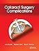 Cataract Surgery Complications