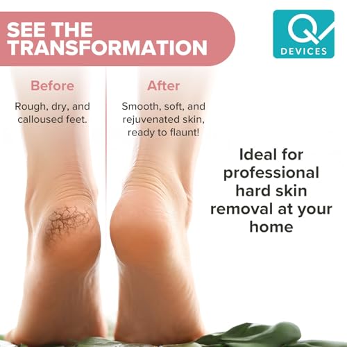 Image of Q DEVICES Electric Foot Callus Remover - Rechargeable Pedicure Tool with 2 Grinding Heads, Waterproof & Travel-Friendly Design for Smooth, Soft Feet