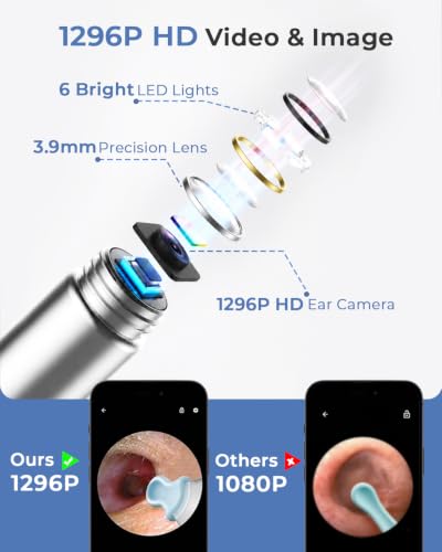 Image of ELECTOMANIA Wireless Ear Wax Removal Tool Kit with 1296P HD Camera 6 LED Lights & Wifi Connection, Ear Cleaning Machine with 5 Silicone Tips Free, Light Weight, IP67 Waterproof for iOS and Android