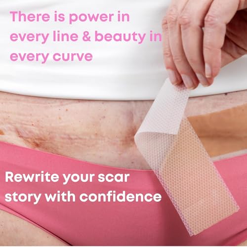 Image of Advanced Silicone Scar Sheets for Women, Medical grade silicone scar tape, Customized for Moms, Extra Long 1.6 inch x 60 inch, New Easy-Use Tear-Lines, Surgical Scars, C-Section, Tummy Tuck, Face Wrinkles