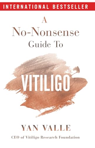 A No-Nonsense Guide To Vitiligo: Second Edition (2024): Valle, Yan
