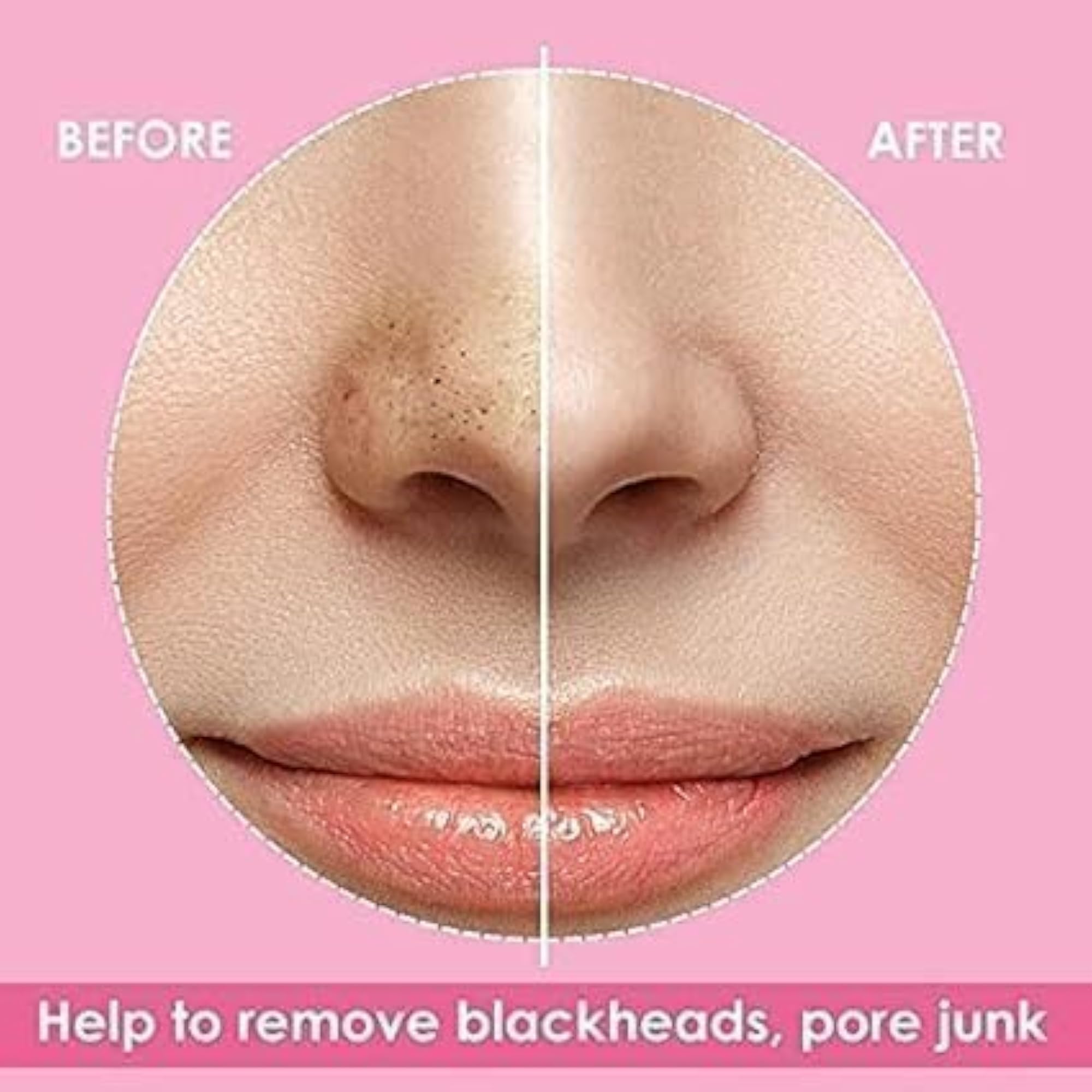 Nose Strips, Blackhead Remover & Pore Cleanser