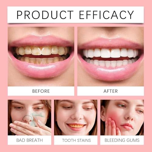 Sp-8 Probiotische Zahnpasta,Tiefenreinigende Pflege-Zahnpasta, Entfernt Flecken,Zahnpflege,Erfrischt Den Atem (3PCS, Natürliche Minze) – Bild 7