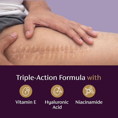 Mederma Scar Serum – Triple-Action Formula with Vitamin E, Hyaluronic Acid & Niacinamide – Clinically Shown to Reduce Old Scars, 1 Fl. Oz