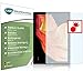 Produktbild Slabo 2 x Panzerschutzfolie für Chuwi UBook (11,6") Panzerfolie Displayschutzfolie Schutzfolie Folie Shockproof KLAR