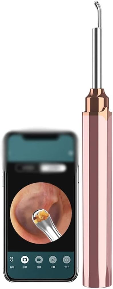 Ear Wax Removal Kit Wireless Smart, 500W Pixel HD, Ear Scoop Cleaner Camera Otoscope Metal, APP Connection(Green Color)
