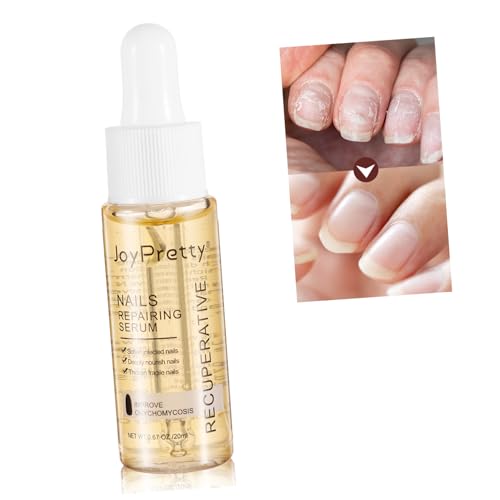 minkissy 1 Pc Esencia De Reparación De Uñas Agente De Mudanzas Cortaúñas Deshidratador Tratamiento De Crecimiento De Uñas Polaco Gel Constructor Clavo Medicina Herbaria China