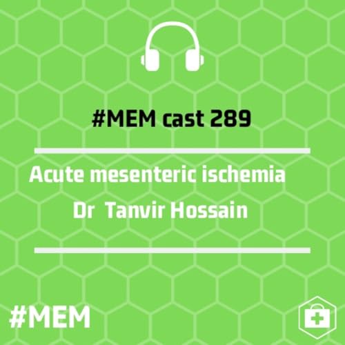 Episode 292: Acute Mesenteric Ischemia