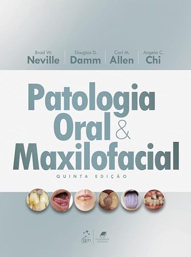 Patologia Oral e Maxilofacial