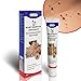 Produktbild Unisex Warzenentfernung Salbe Warzenbehandlung Creme Skin Tag Remover Kräuterextrakt Maispflaster Warzensalbe 20g