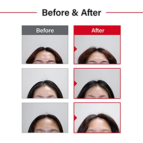 Dr.forhair Folligen Original Anti-Thinning Biotin Shampoo (16.9 Oz) Hair Regrowth & Thickening Anti Hair Loss & Thinning Increase Growth Volume Strength Treatment Root Enhancer (No Parabens, Silicone, Sulfates) #TOP4